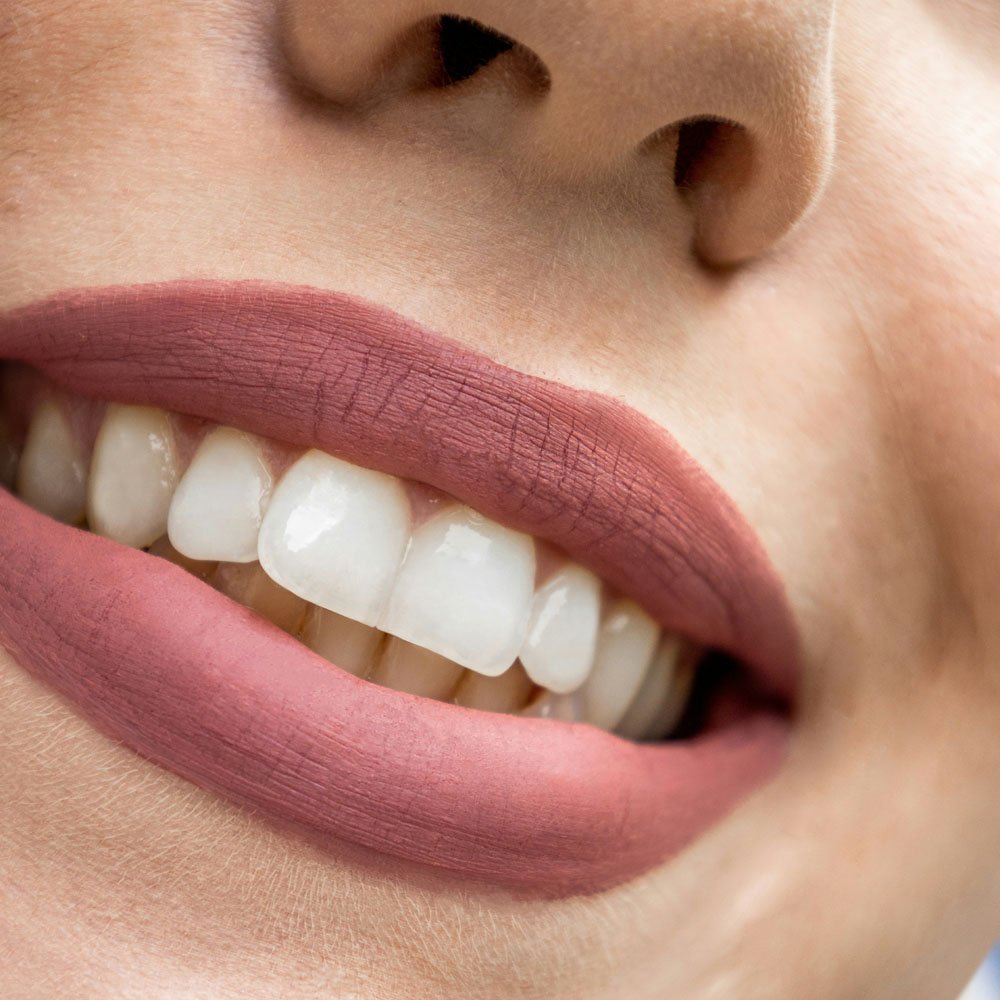 Zoom Teeth Whitening
